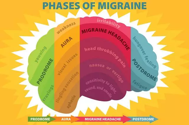 Migraine headache details